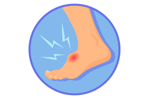 Foot Hurt Medical Illustration. Pain Spo